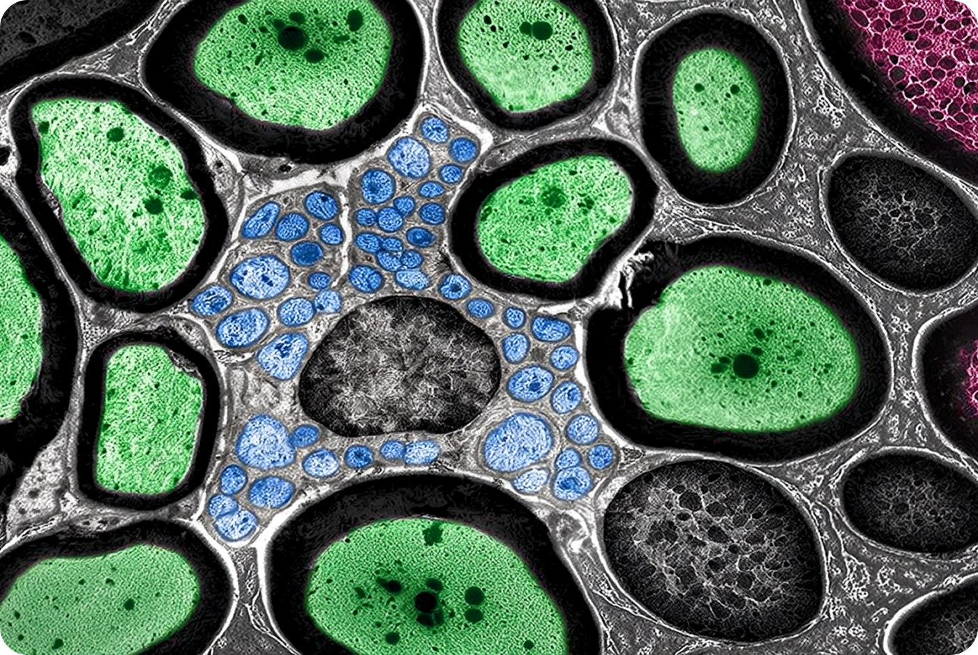 Target identification