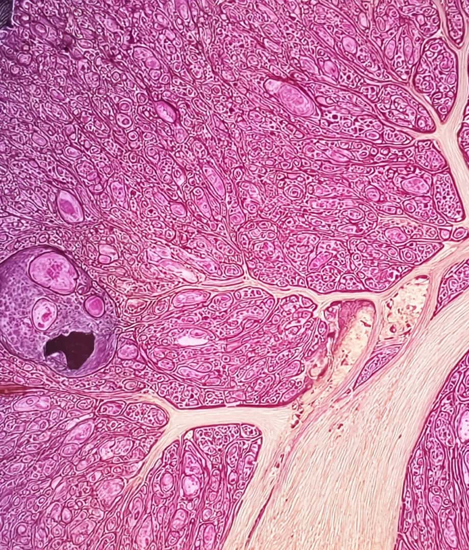 Clinical development strategy