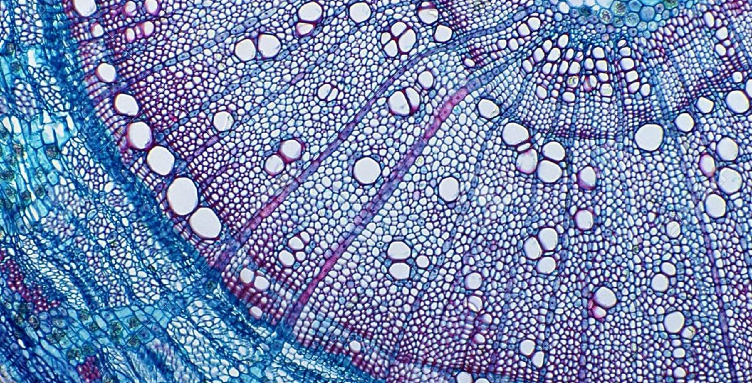 Microscopic cross-section of a plant stem