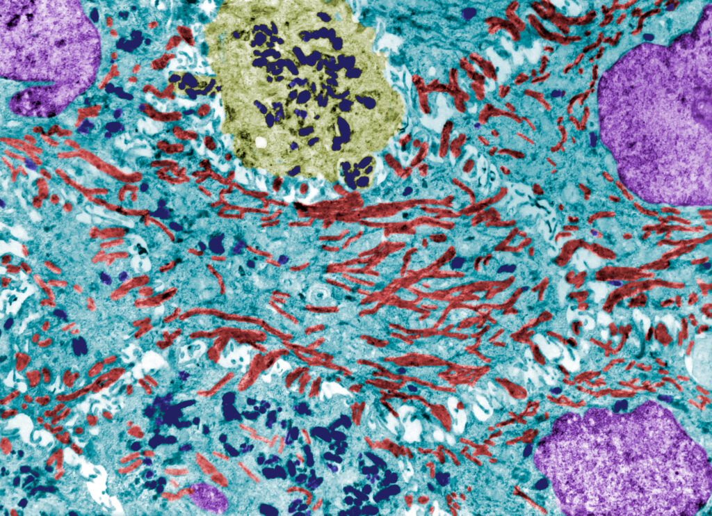 AI in Biopharma: Benchmarking LLM foundation models