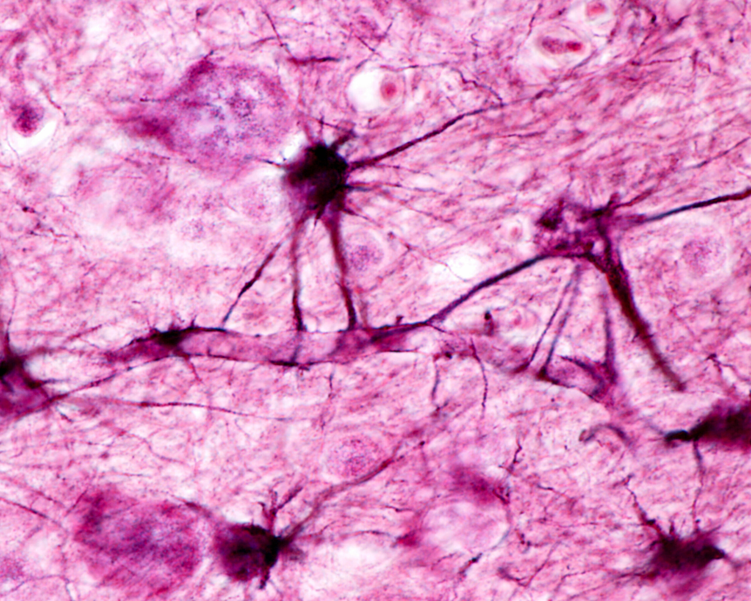 Transporting Macromolecules Across the Blood-Brain-Barrier: The Next Frontier in CNS Disease Treatment